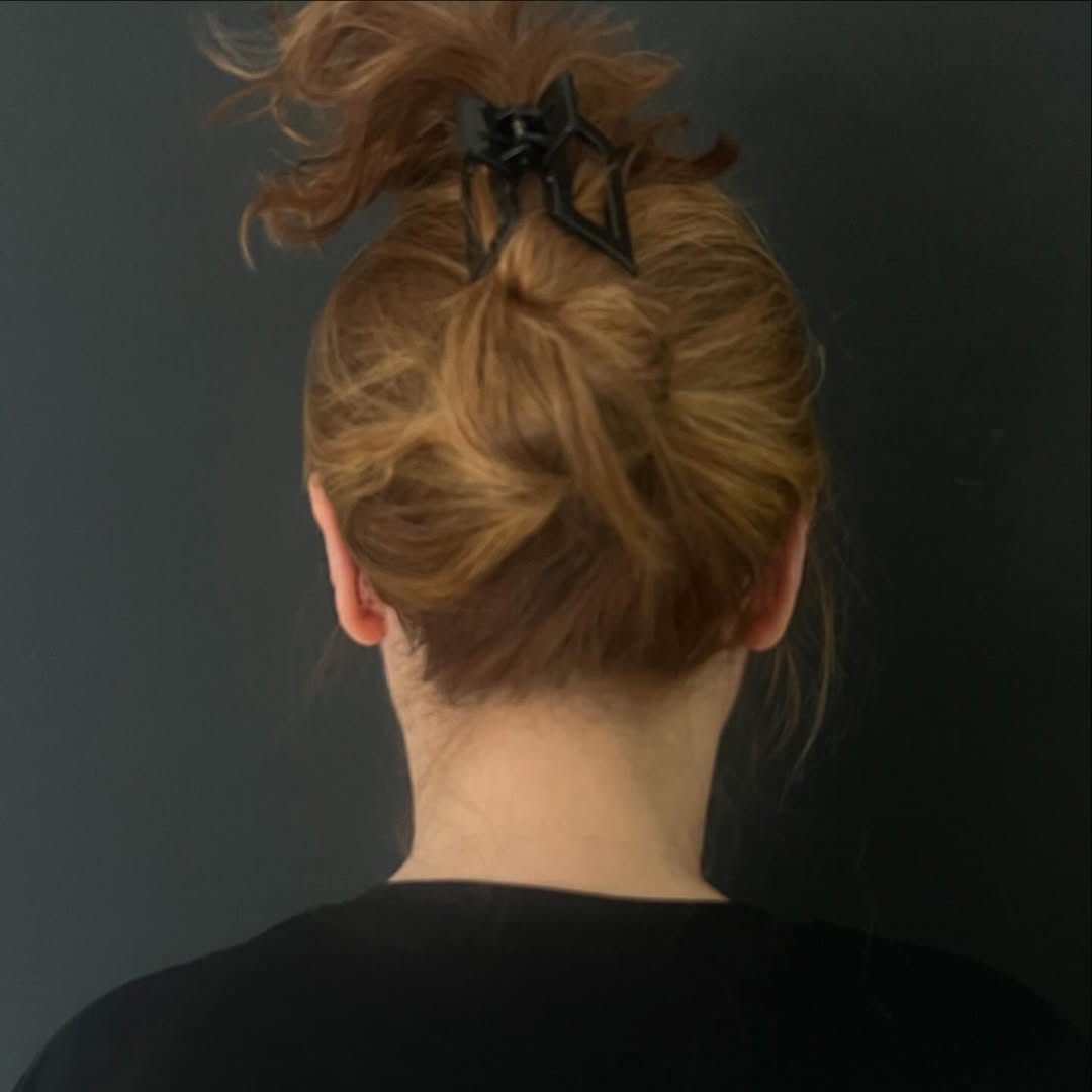 Отопластика